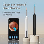 6-in-1 Smart Ear Wax Removal Kit with 1080P HD Camera – Safe, Rechargeable Ear Cleaner for iPhone, iPad & Android